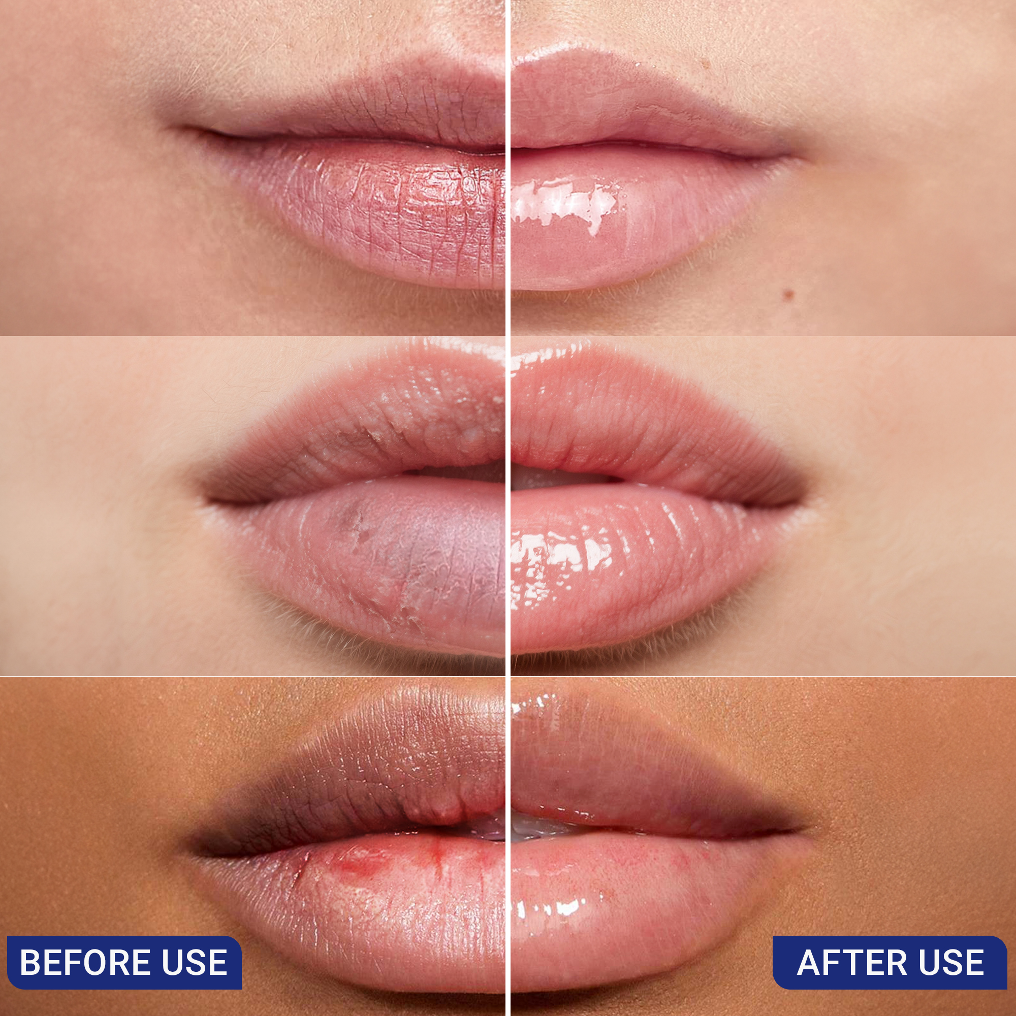 Angelyn Repair Lip Oil – Hydrating & Plumping Clear Lip Serum, Overnight Lip Mask, Moisturizing Lip Balm for Soft, Smooths Lips, with Vitamins C & E